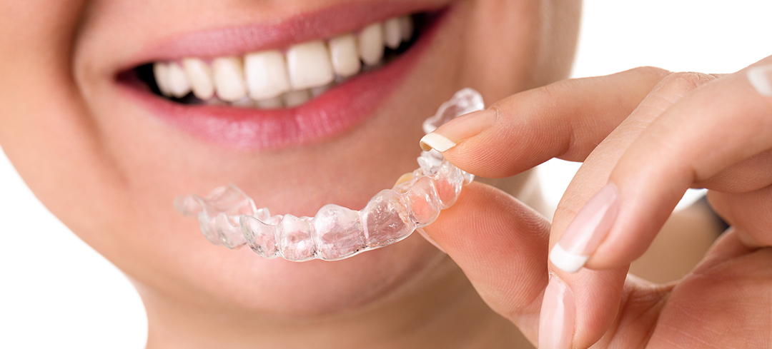 What are invisible braces and how do they work?